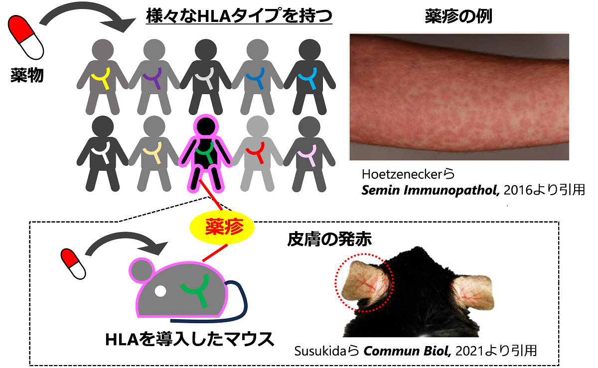 HLA依存的に生じる薬疹とマウスを用いた再現実験